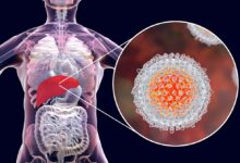 Photo of लिवर में सूजन हो सकता है हेपेटाइटिस का इशारा, जानें बचाव के असरदार तरीके