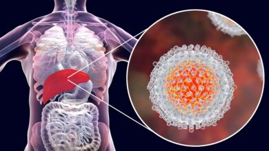 Photo of लिवर में सूजन हो सकता है हेपेटाइटिस का इशारा, जानें बचाव के असरदार तरीके