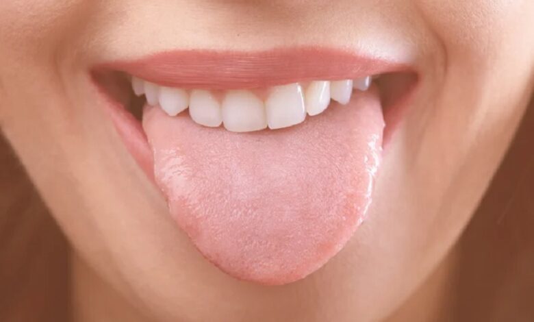 Signs of Bad Health on Tongue