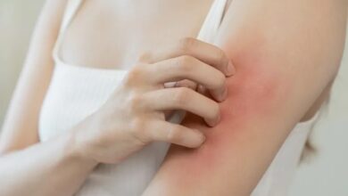 Photo of बरसात के मौसम में इन वजहों से बढ़ जाता है फंगल इन्फेक्शन, ऐसे करें बचाव