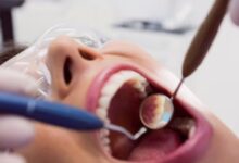 Photo of खराब ओरल हेल्थ बनती है बड़ी बीमारियों की वजह, ऐसे करें कैविटी से बचाव