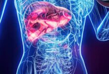 Photo of ज्यादा तला-भुना और फैटी खाना बन सकता है लिवर कैंसर की वजह, आज ही हो जाएं सतर्क